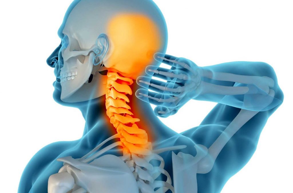 Soffri di cervicalgia? No Pain è la soluzione